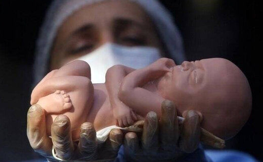 سقط جنین نامشروع